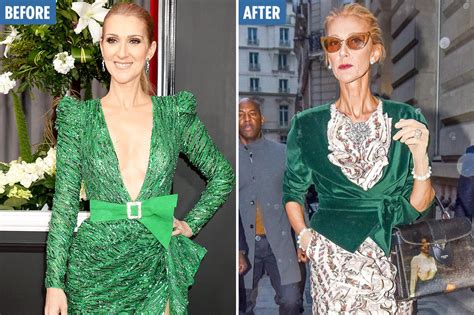 celine dion illness weight loss.